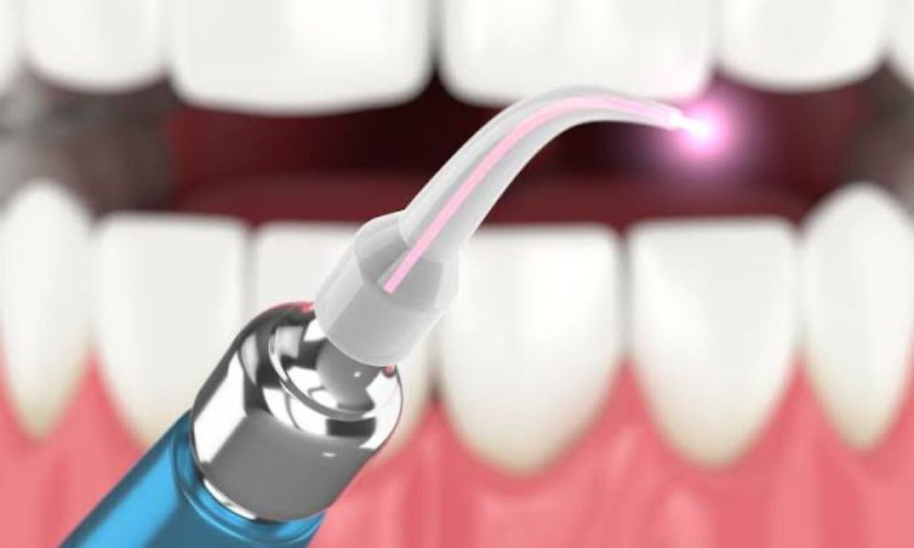 Laser dentistry