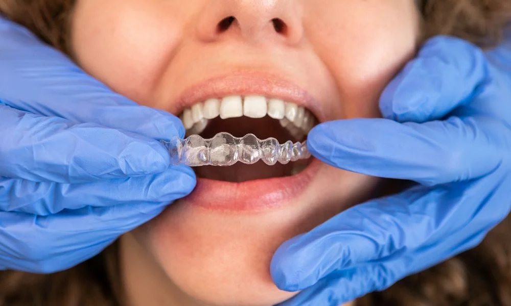 Invisalign Treatment