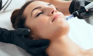 Collagen