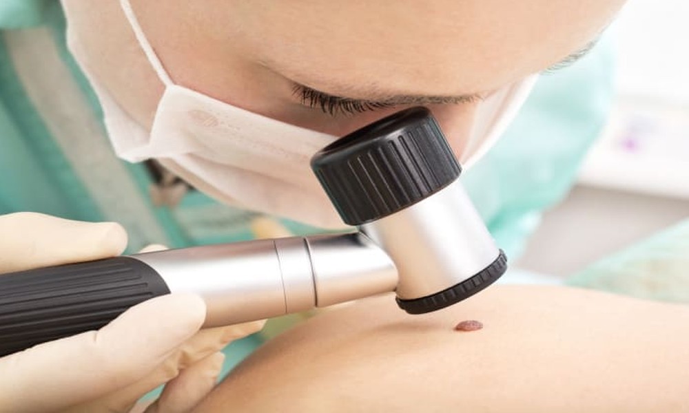Why Seeing a Skin Cancer Doctor in Gold Coast Matters More Than Most People Realise