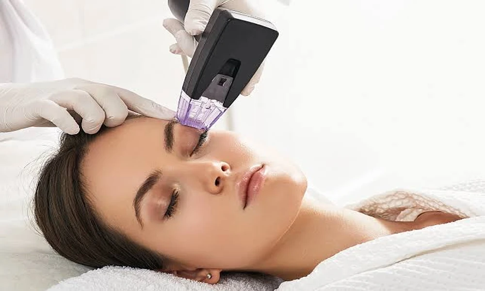 Morpheus8 Skin Tightening: Benefits You Might Overlook